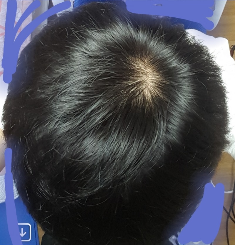 20181111_000713.jpg
