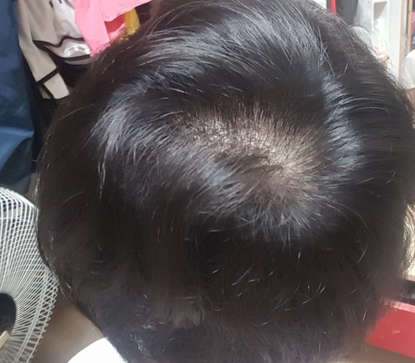샴푸후찍은사진입니다