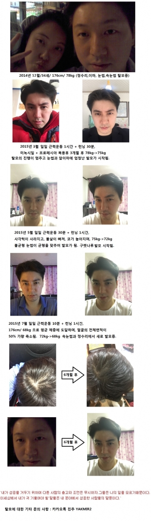 탈모.jpg