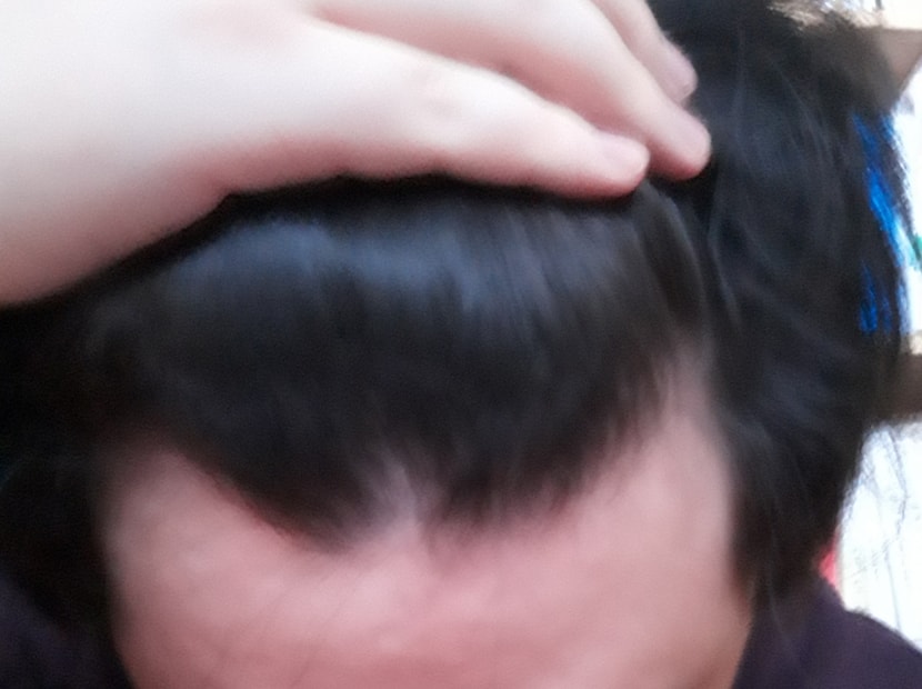 1년후...