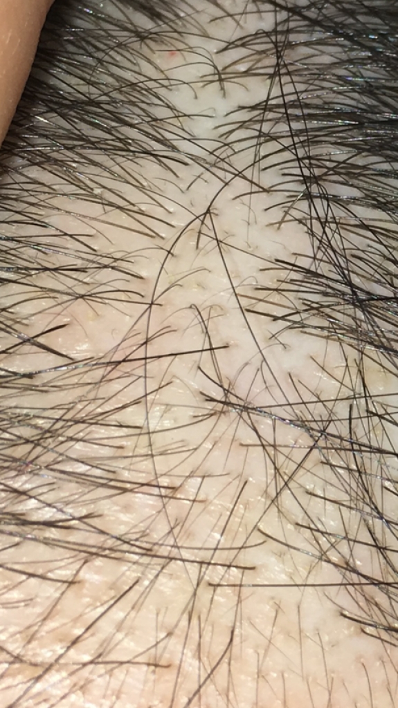 C20FCDCE-4A82-429A-99A0-F1820E088EB7.png
