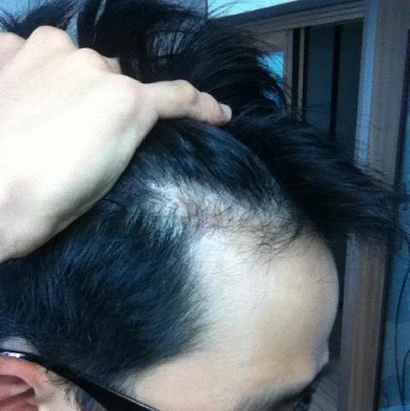 d우측3.JPG