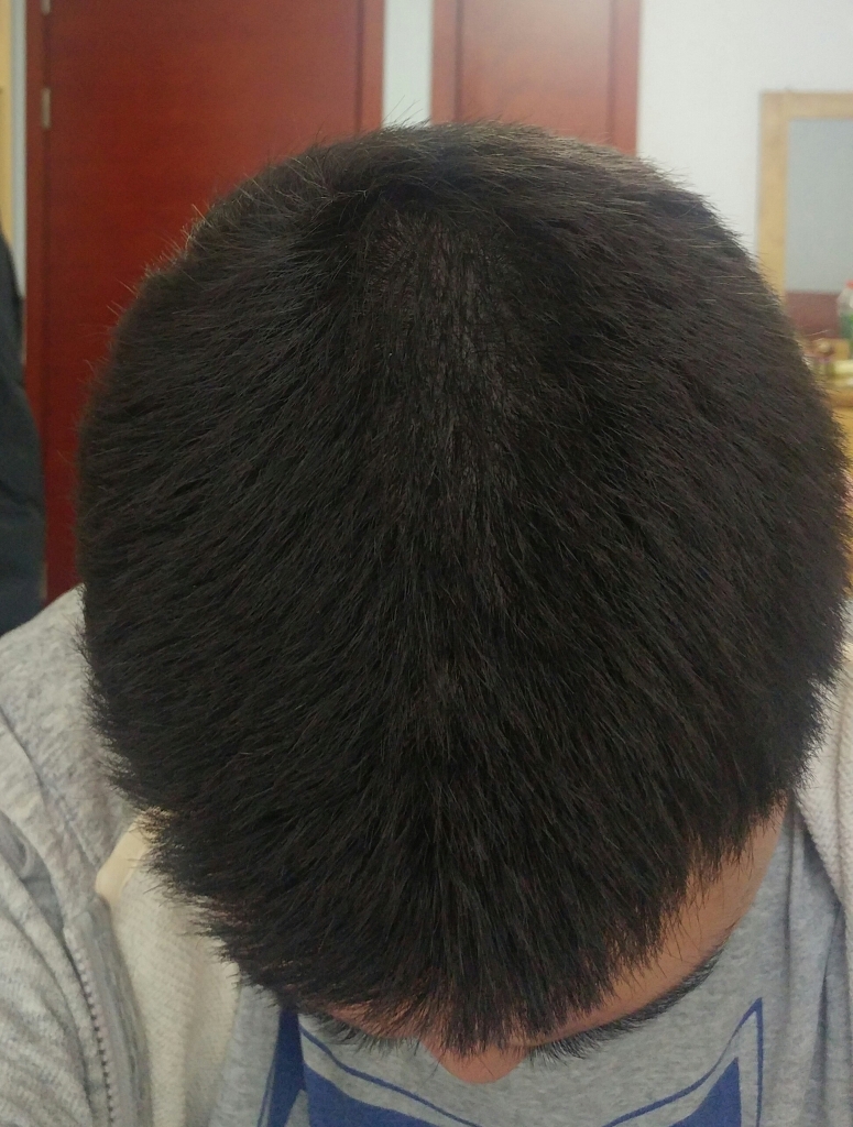 20180317_170932-1.jpg