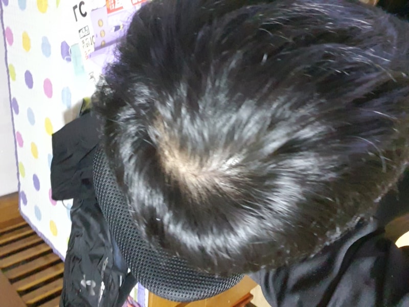 정수리1.jpg