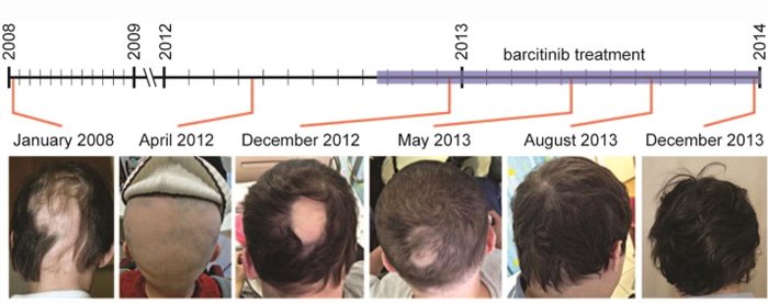 rsz_baricitinib-results.jpg