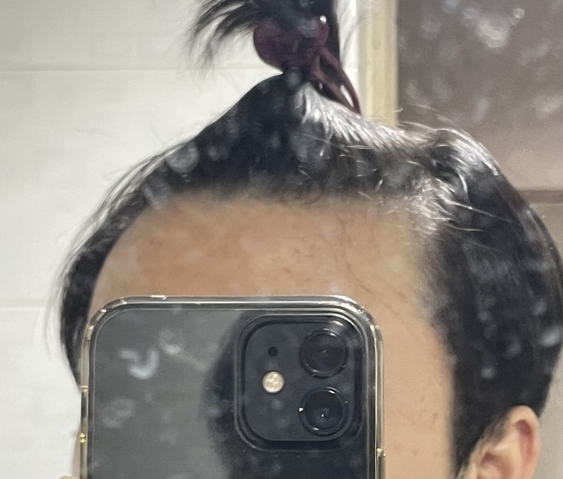 약복용 해야될까요