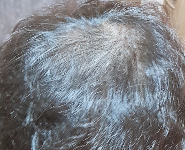 SmartSelect_20180705-141650_Gallery.jpg