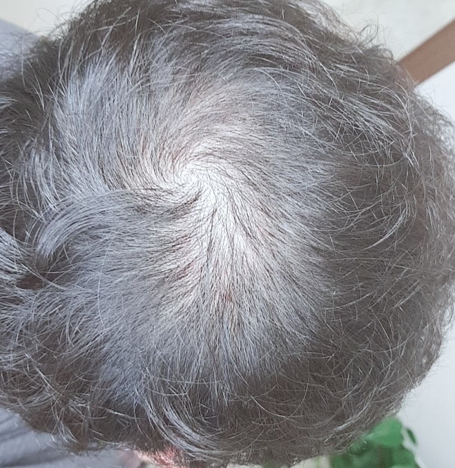 SmartSelect_20180705-141734.jpg