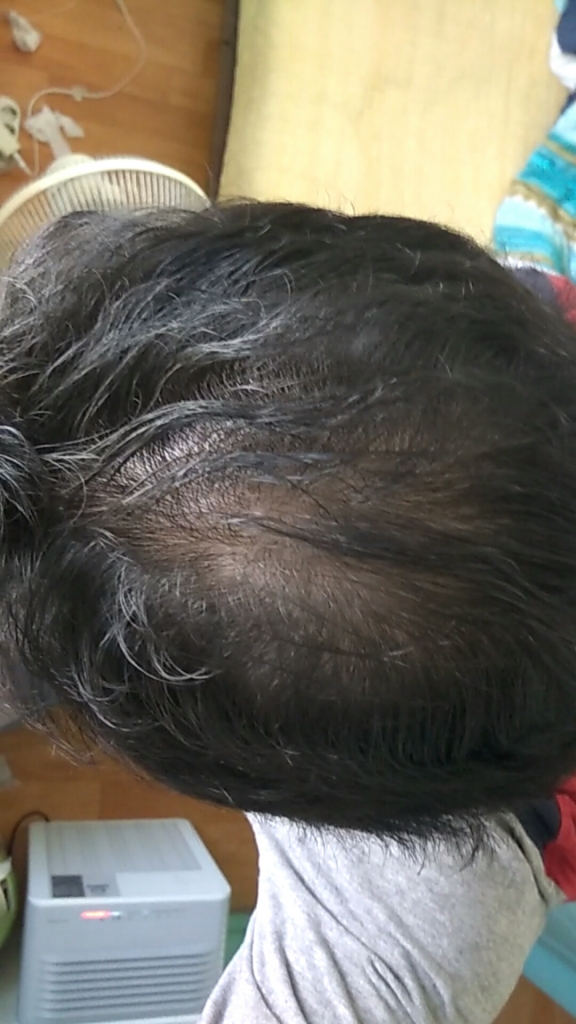 myhair.png