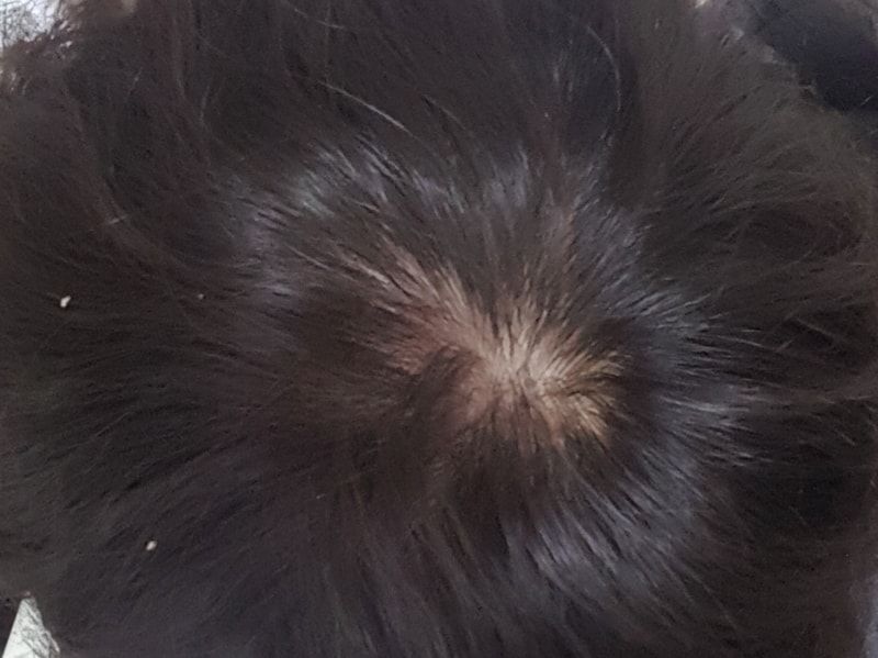 20190307_082735.jpg