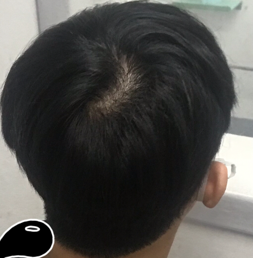 A8CF7CA9-80D0-44A3-BF85-35D0F6FF1058.png