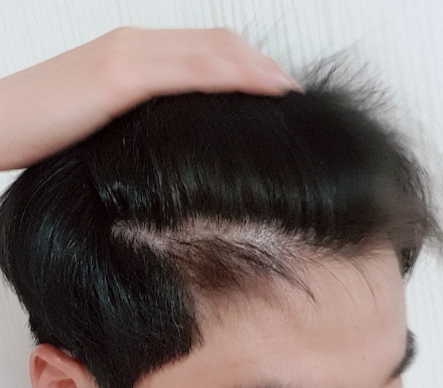 20180225_213505.jpg