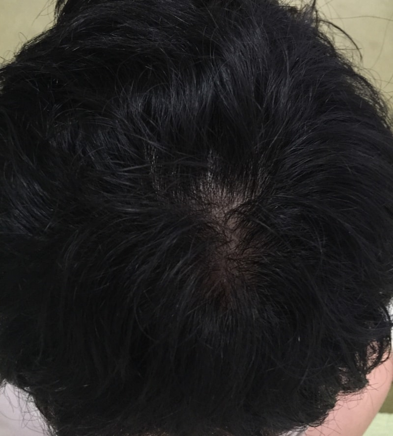 image.jpg