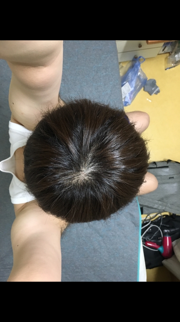 2DA3F79C-332A-4E05-A9B3-CDD6DEF0B7D3.png
