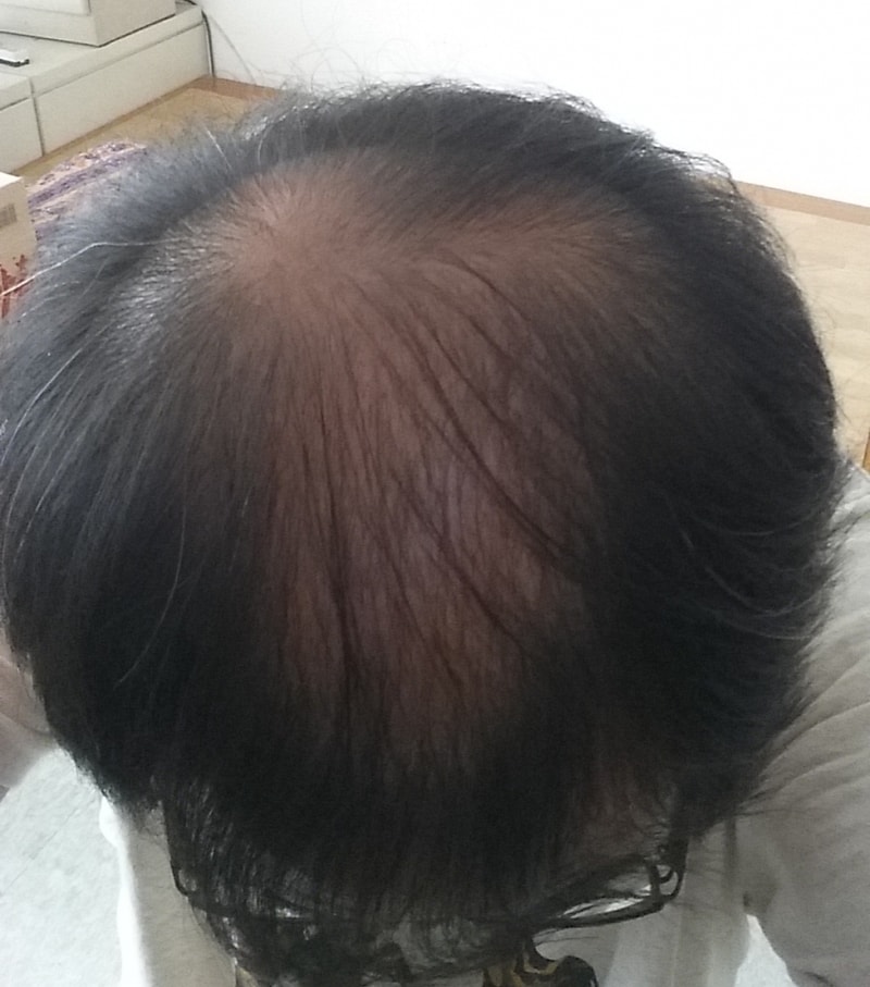 머리상태.jpg