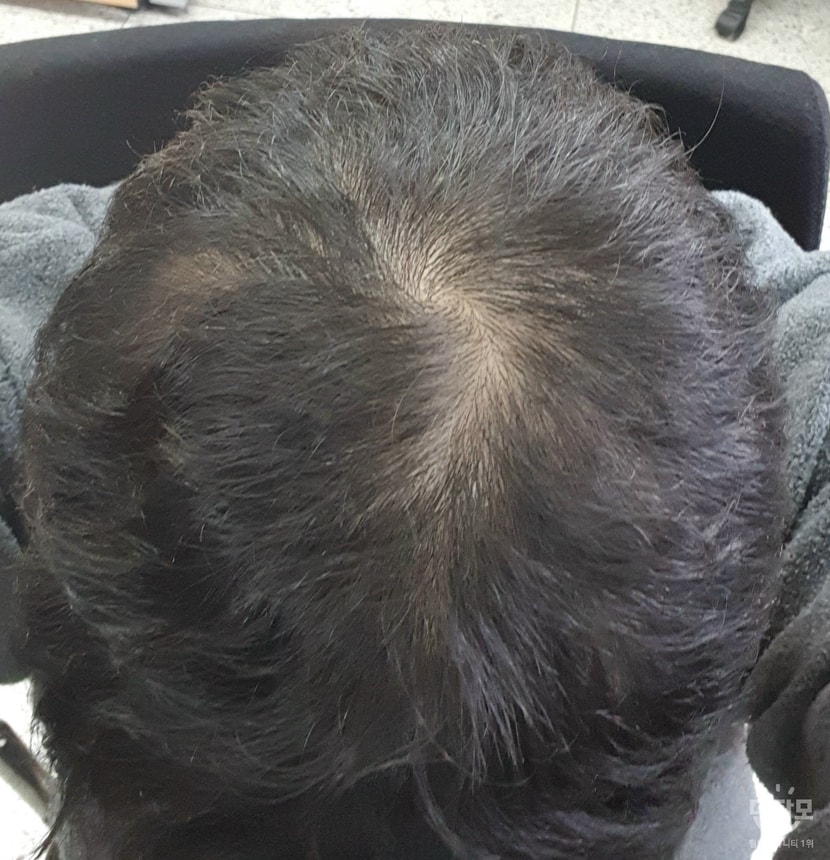 먹기전 사진
