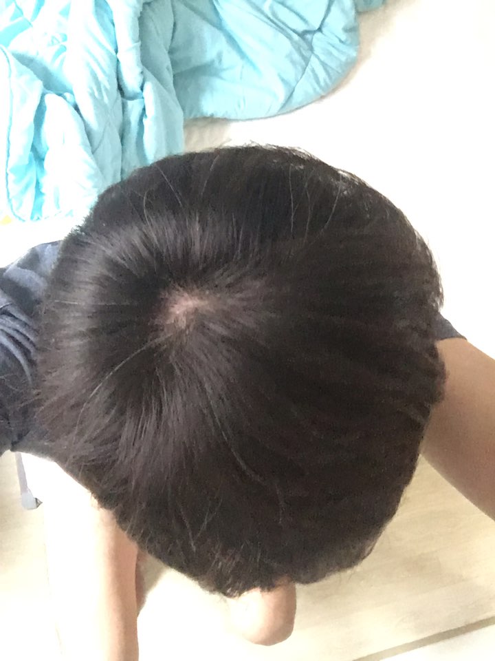 머리2.jpg
