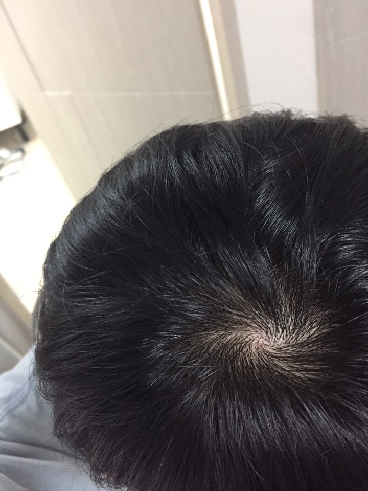 머리감고 말렸을때
