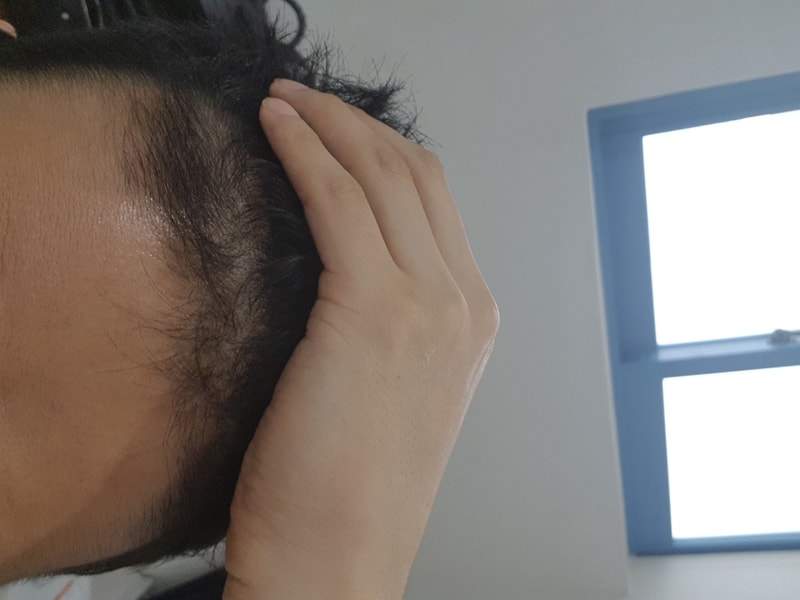 복용 3개월 앞.jpg