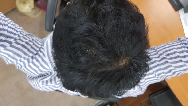 복용 3개월.jpg