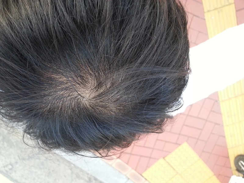 20170914_181859.jpg