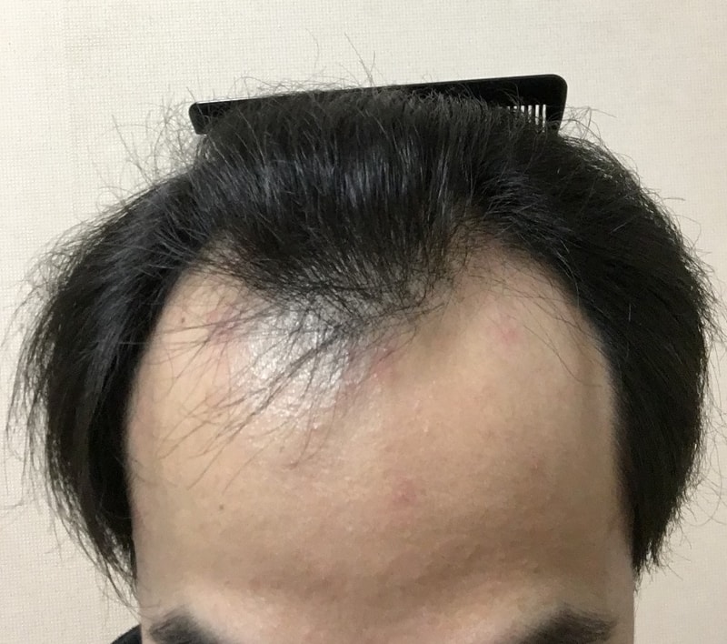 3.JPG