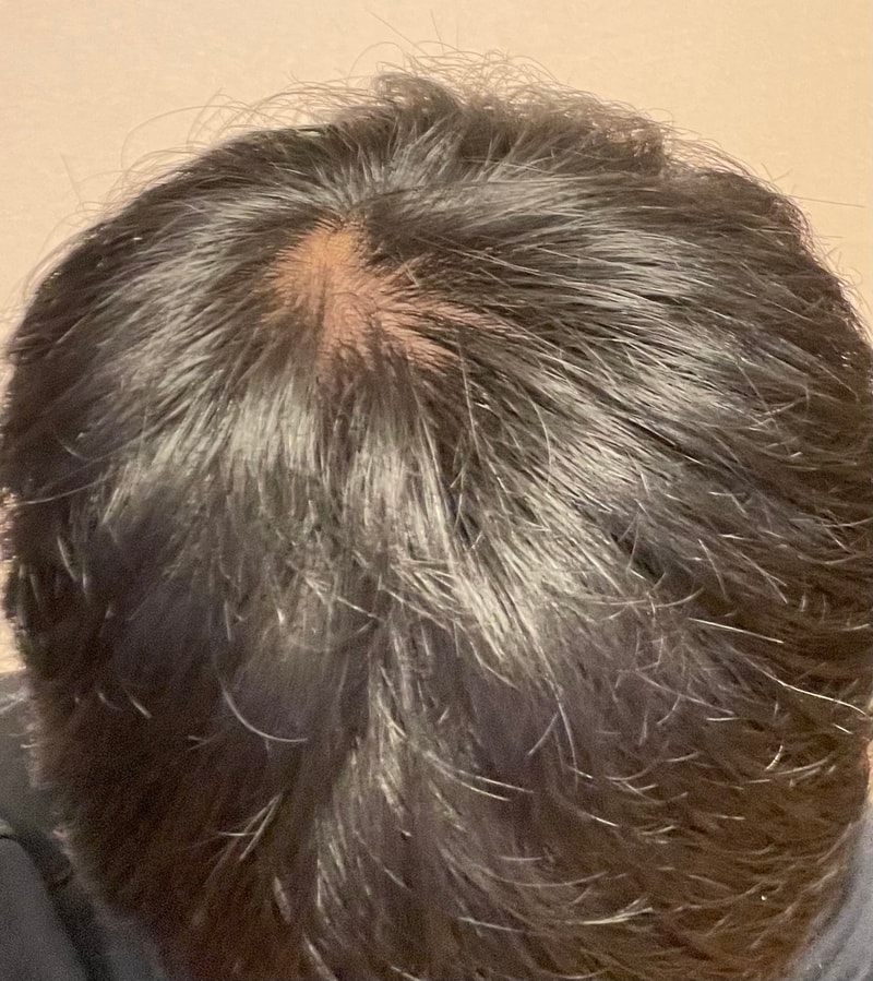 B539D7CE-0712-42FF-B46D-E3B4E1B33150.jpeg