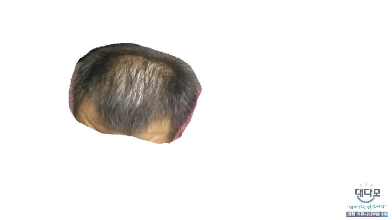 약먹기 2년 7개월전
