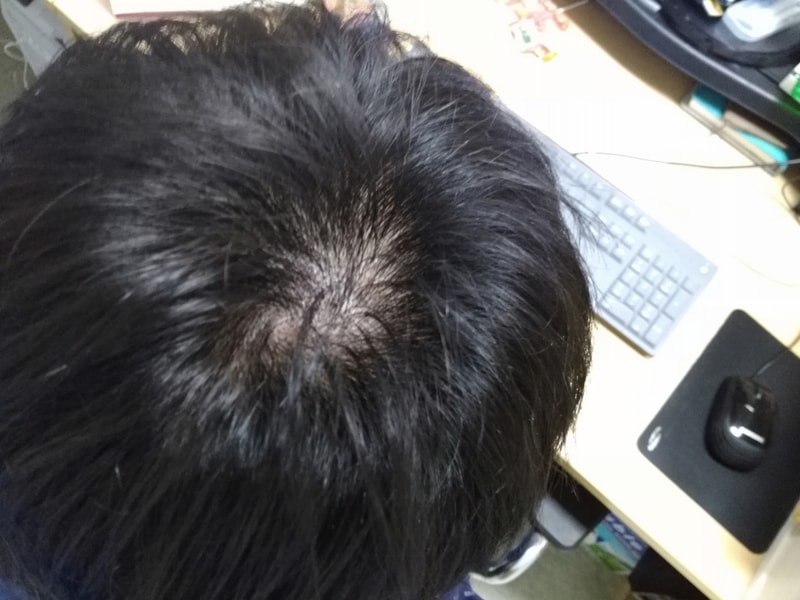 크기변환_KakaoTalk_20170818_091418873.jpg