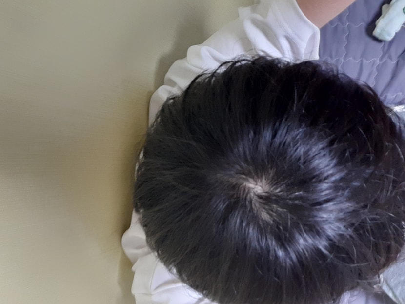 정수리
