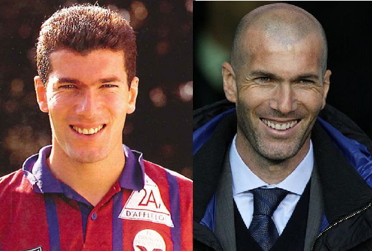 Zidane-with-Hair[1].png