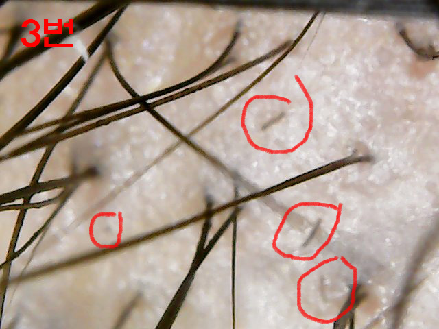 3번.jpg