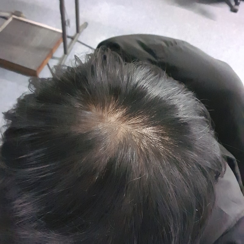 모발2.jpg