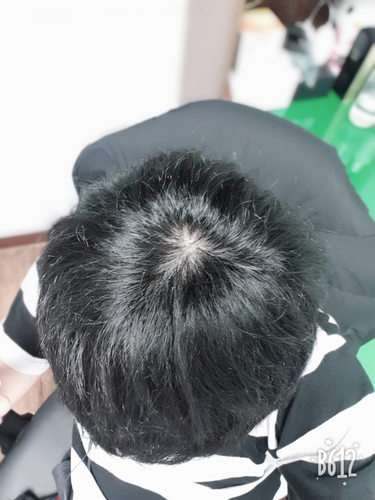 B612_20190228_212900_551.jpg