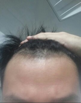 160109 m자 4.jpg