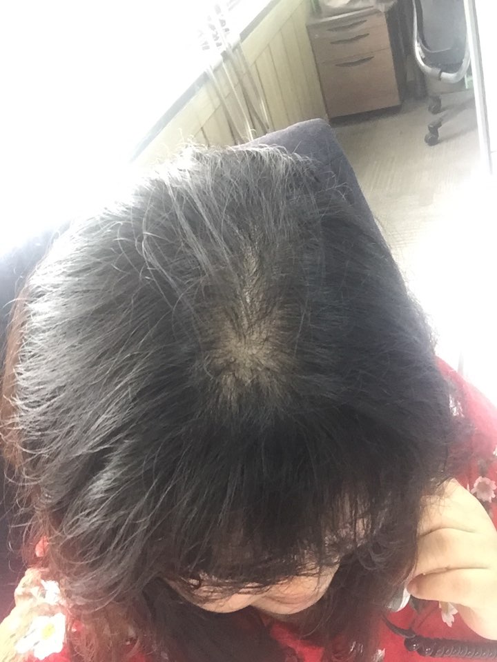 KakaoTalk_20170627_103532678.jpg