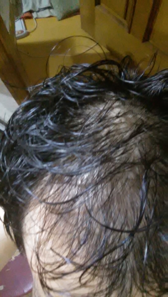20170614_212016.jpg