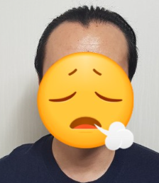 김대성비포.PNG