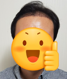 김대성에프터7.PNG