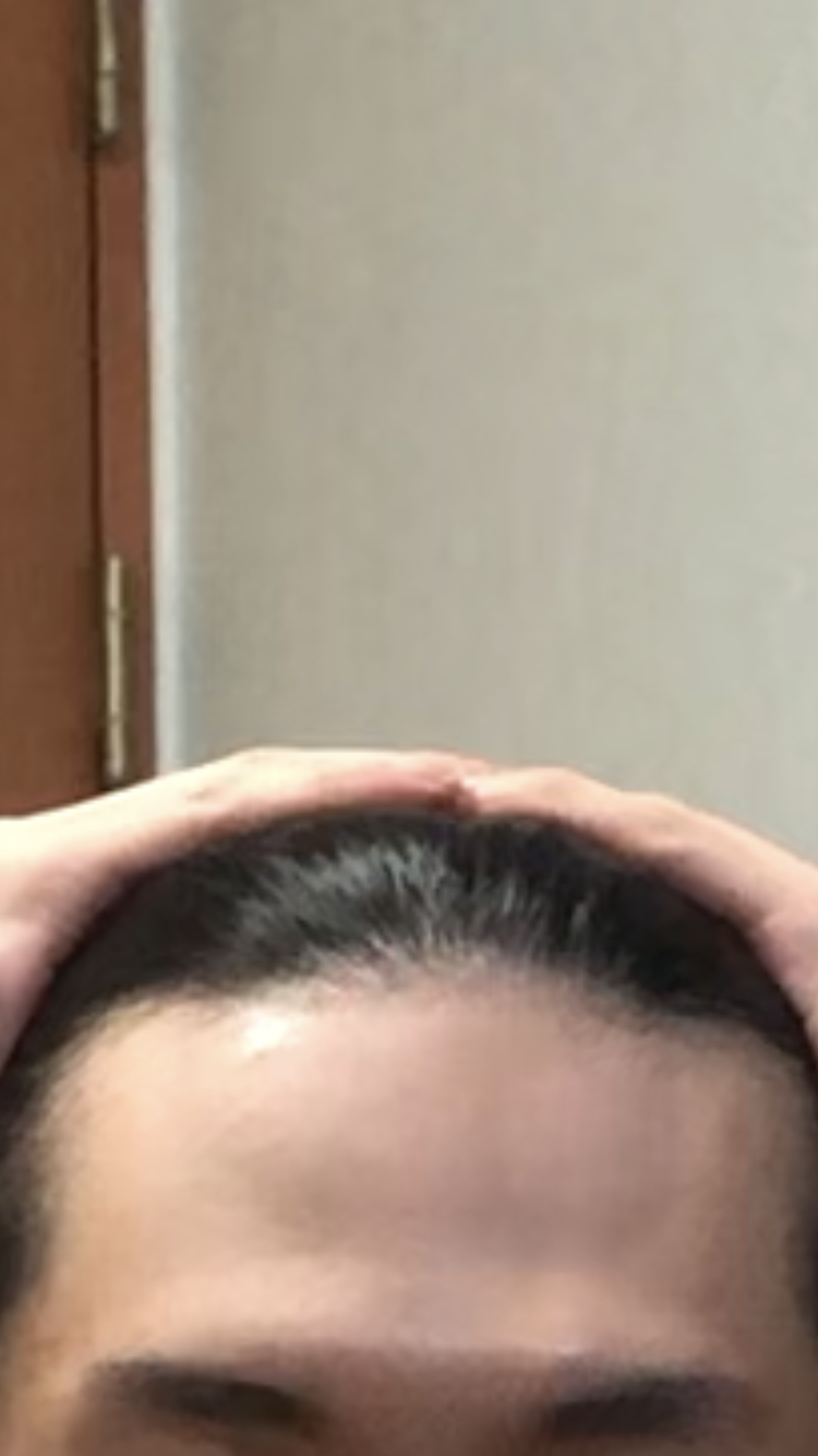 58467B0F-9021-462D-BD2C-F1FF8F9F3512.png