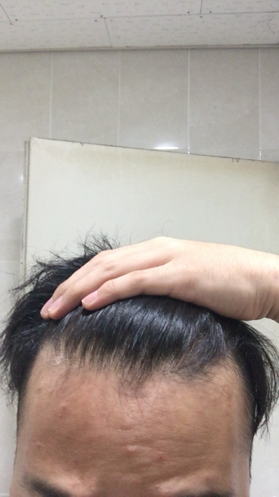 45F0F621-FD8E-4F0A-A445-A0725C173FBF.jpeg