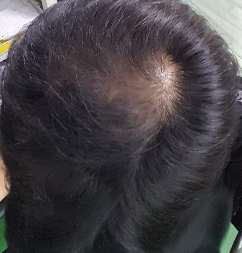 20180728_102410.jpg
