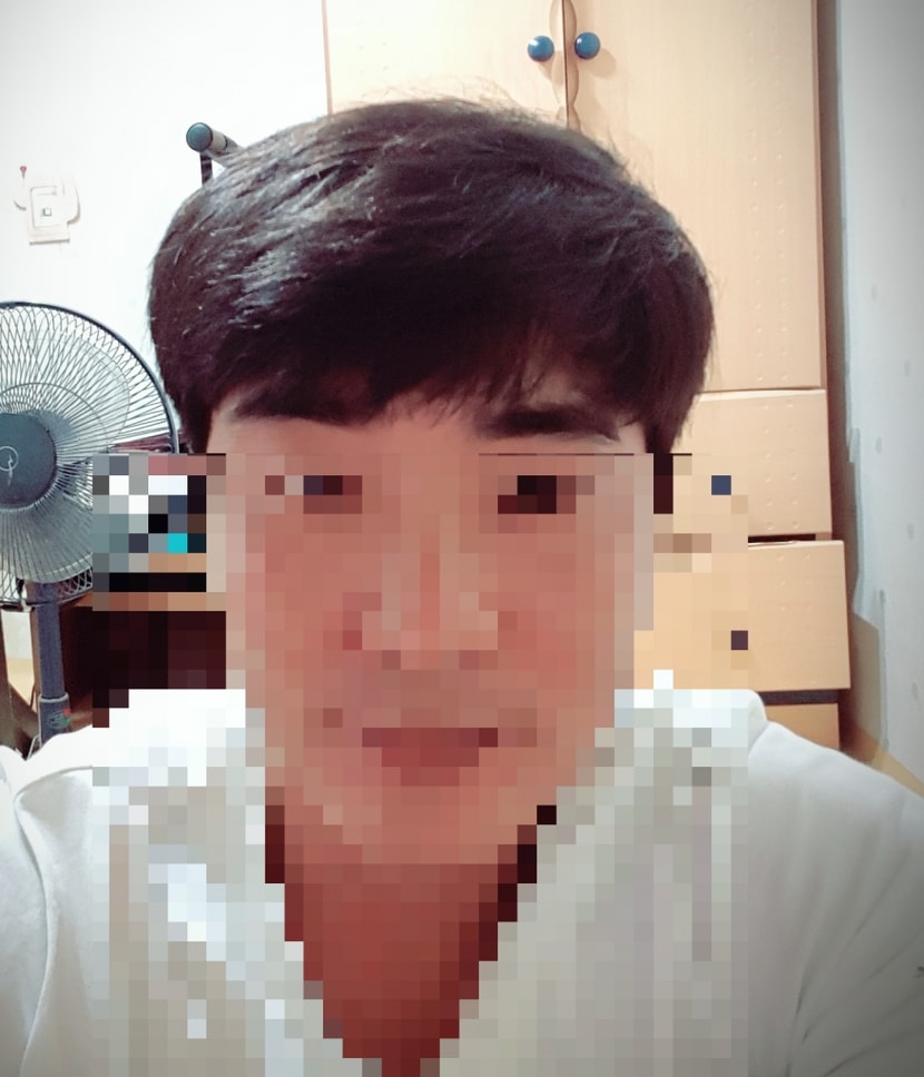 수술두달전