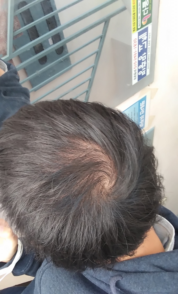 바람에 휘날렀을때 셀카로 거울반사해서 찍었을때 입니다