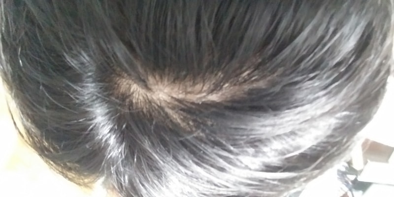 20170820_203640.jpg