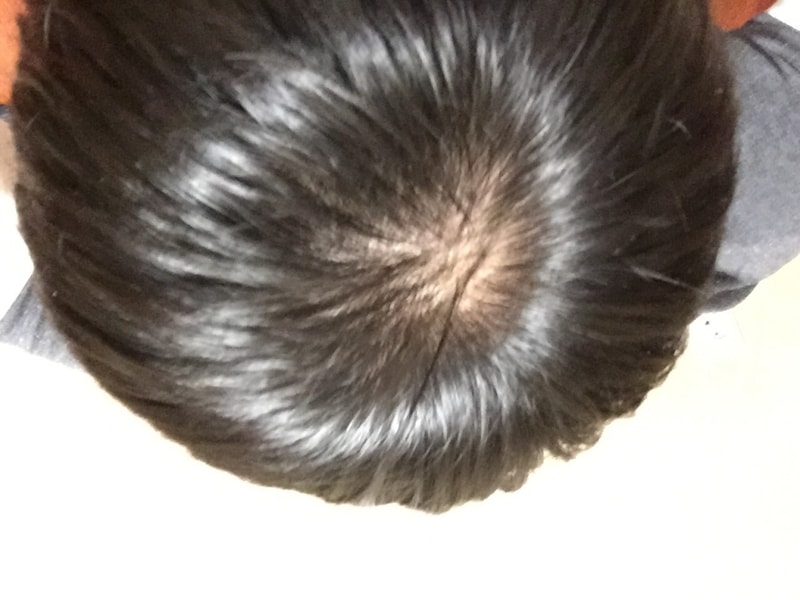 image.jpg