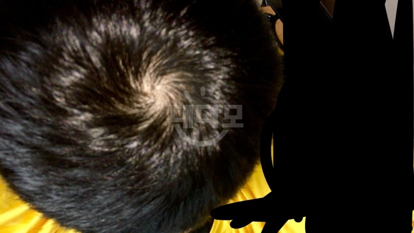 이게 3/10 사진입니다. 