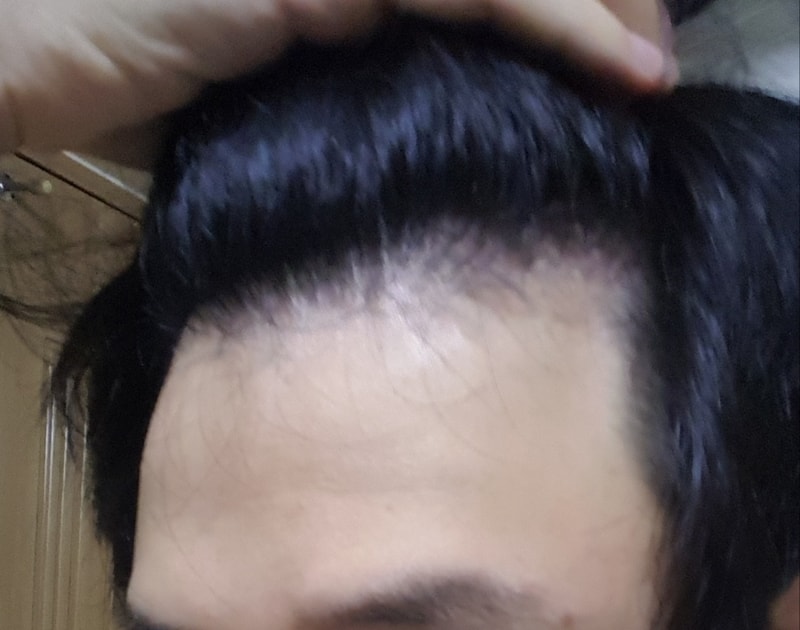 20170318_142548.jpg