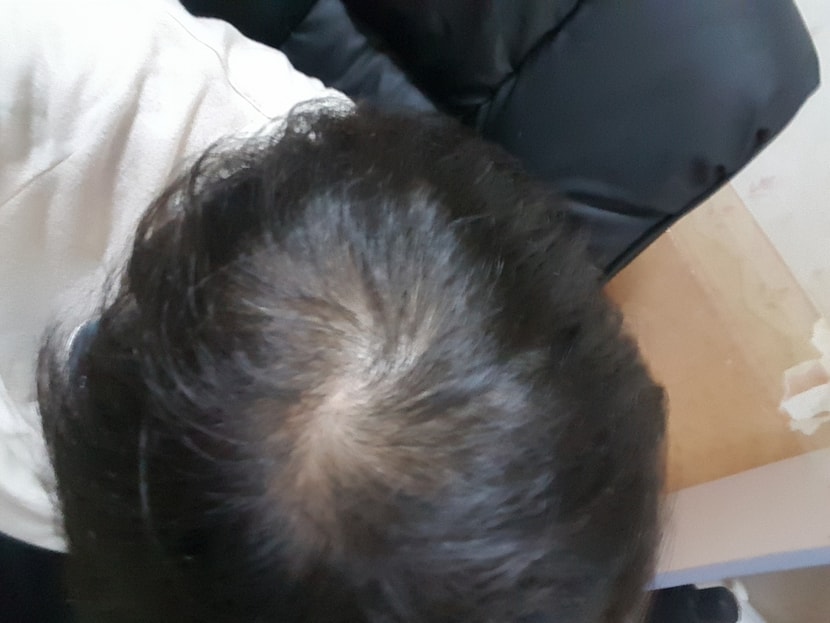 정수리 4/24