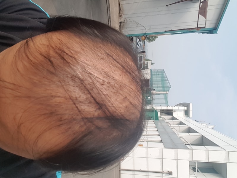 20170609_085429.jpg
